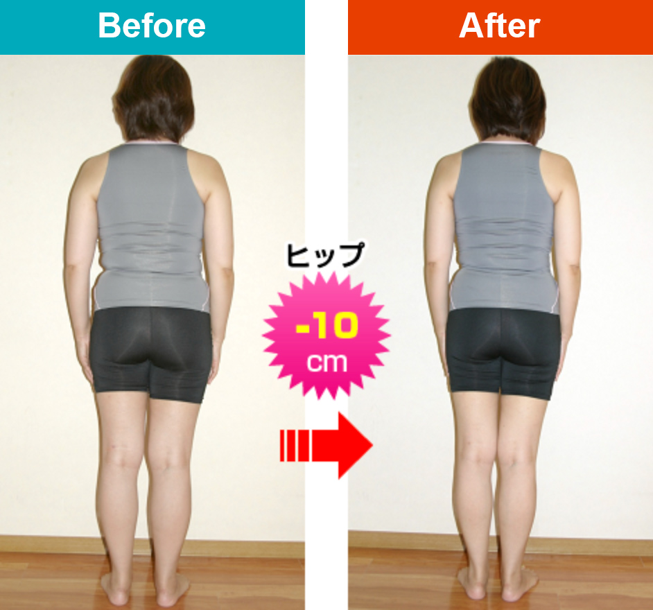 beforeafter